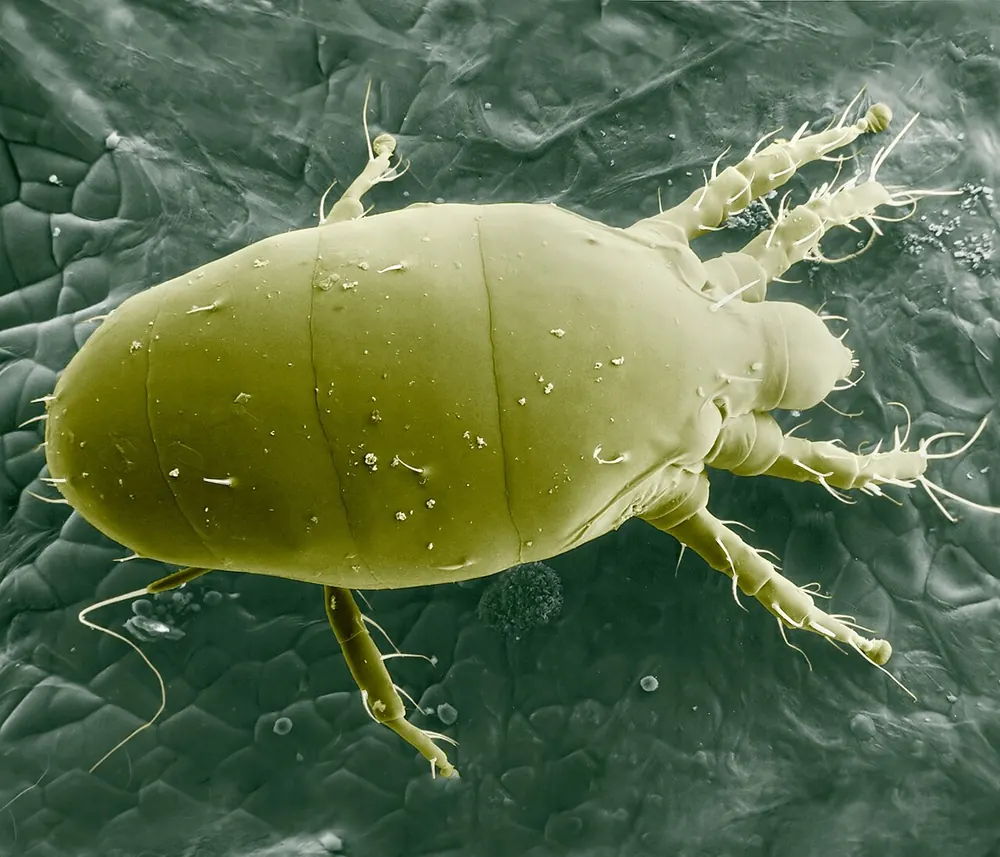 Ácaro blanco visto al microscopio electrónico, imagen coloreada